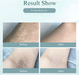 900000 flashes Laser hair removal  Painless Remover Flawless shaver - warewell